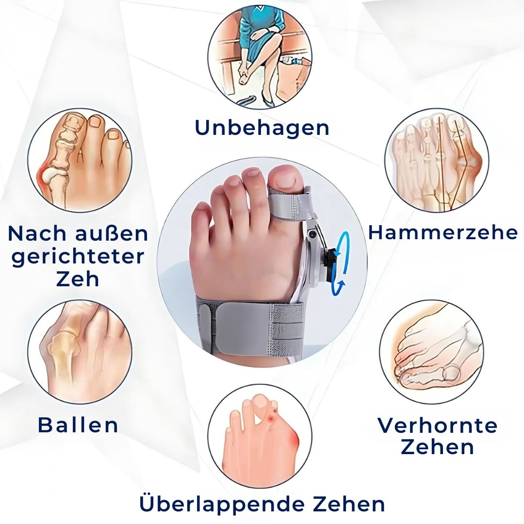 BunionEase Justerbare Lindre Støtter | Hallux Valgus Korrigerer