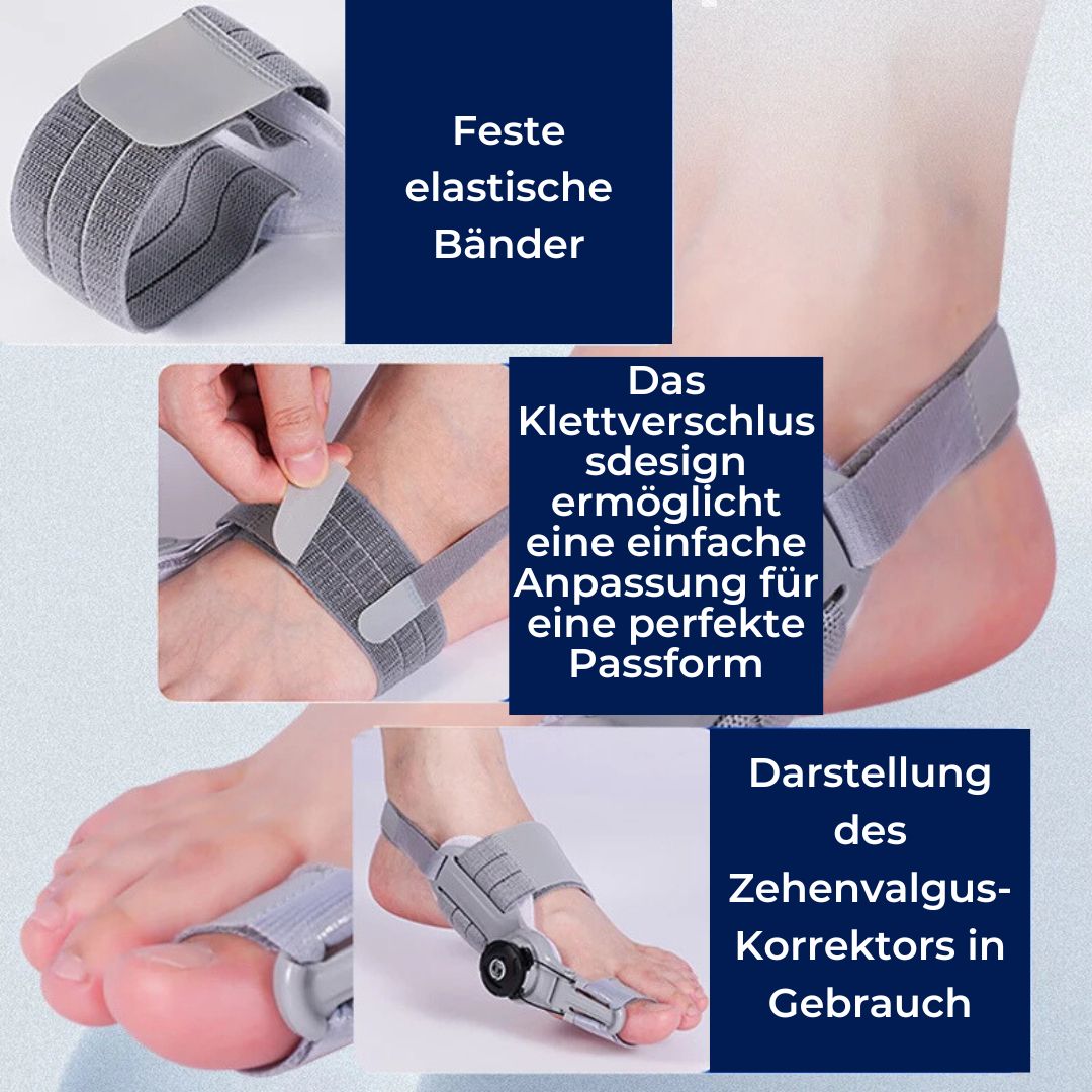 BunionEase Justerbare Lindre Støtter | Hallux Valgus Korrigerer