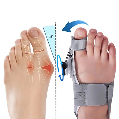 BunionEase Justerbare Lindre Støtter | Hallux Valgus Korrigerer
