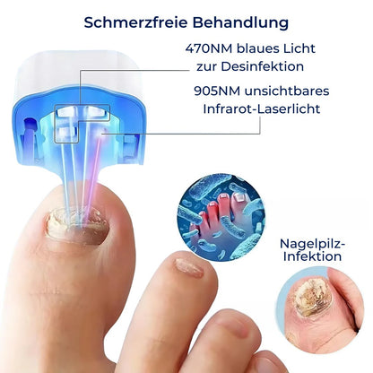 ClearNail Pro | Neglesvamp Laser Enhed - Smertefri - Effektiv