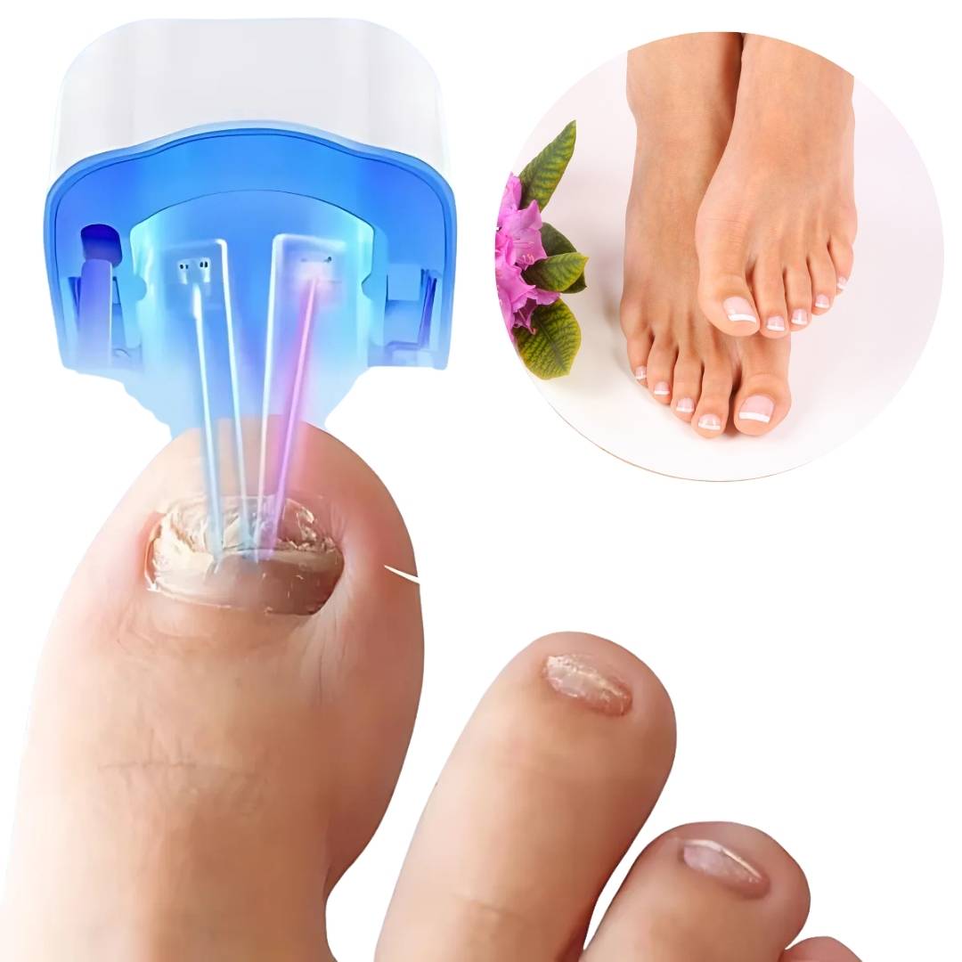 ClearNail Pro | Neglesvamp Laser Enhed - Smertefri - Effektiv
