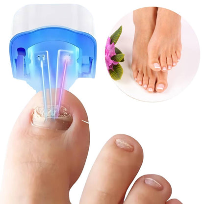 ClearNail Pro | Neglesvamp Laser Enhed - Smertefri - Effektiv