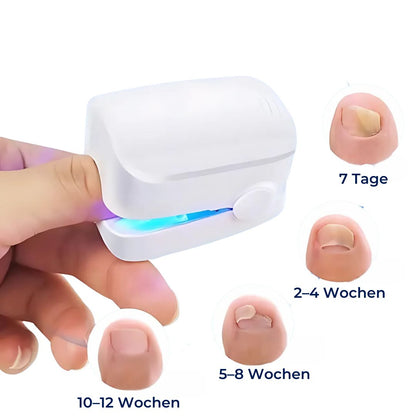 ClearNail Pro | Neglesvamp Laser Enhed - Smertefri - Effektiv