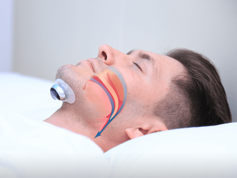 Genopladeligt Anti-Snorkeapparat med Puls Teknologi