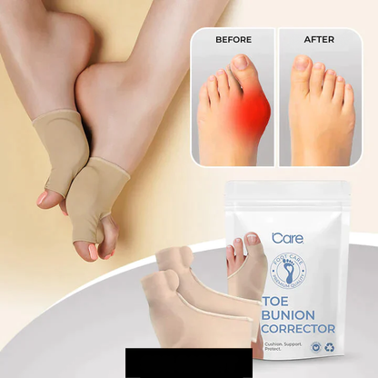 Hallux Valgus | Tå Korrigerer | Trykaflastning Mens Du Går | ToeAlign