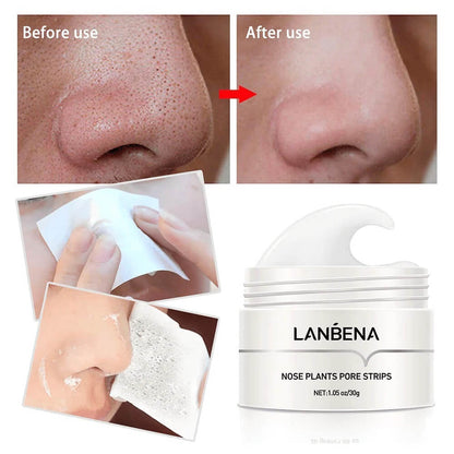 LANBENA Ansigtsmaske til Blackheads