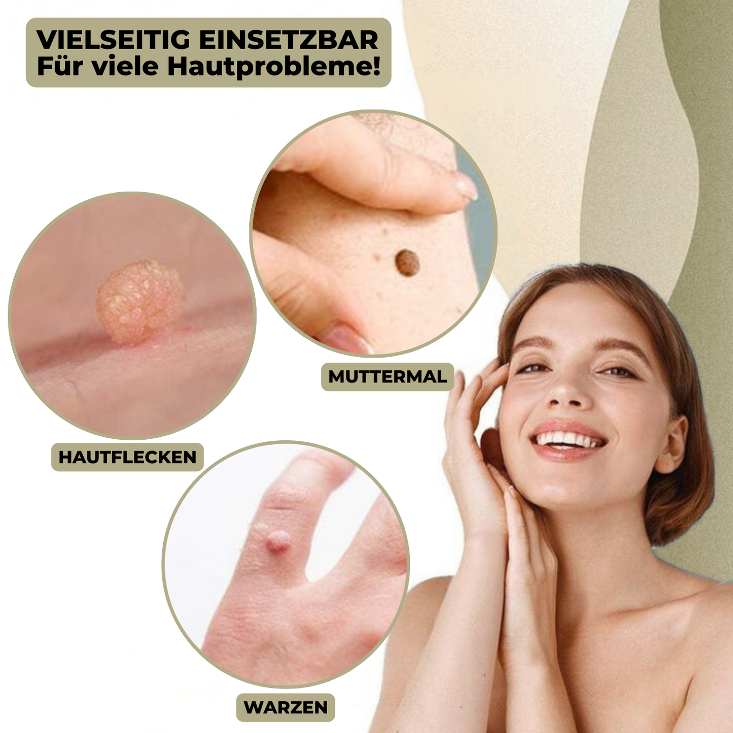 Marcelie | DermaLinx Vortefjerner | Smertefri Fjernelse af Vorter & Modermærker | Til Hjemmet | Uden Kirurgi