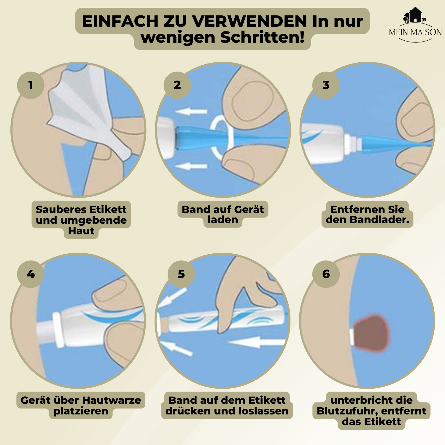 Marcelie | DermaLinx Vortefjerner | Smertefri Fjernelse af Vorter & Modermærker | Til Hjemmet | Uden Kirurgi