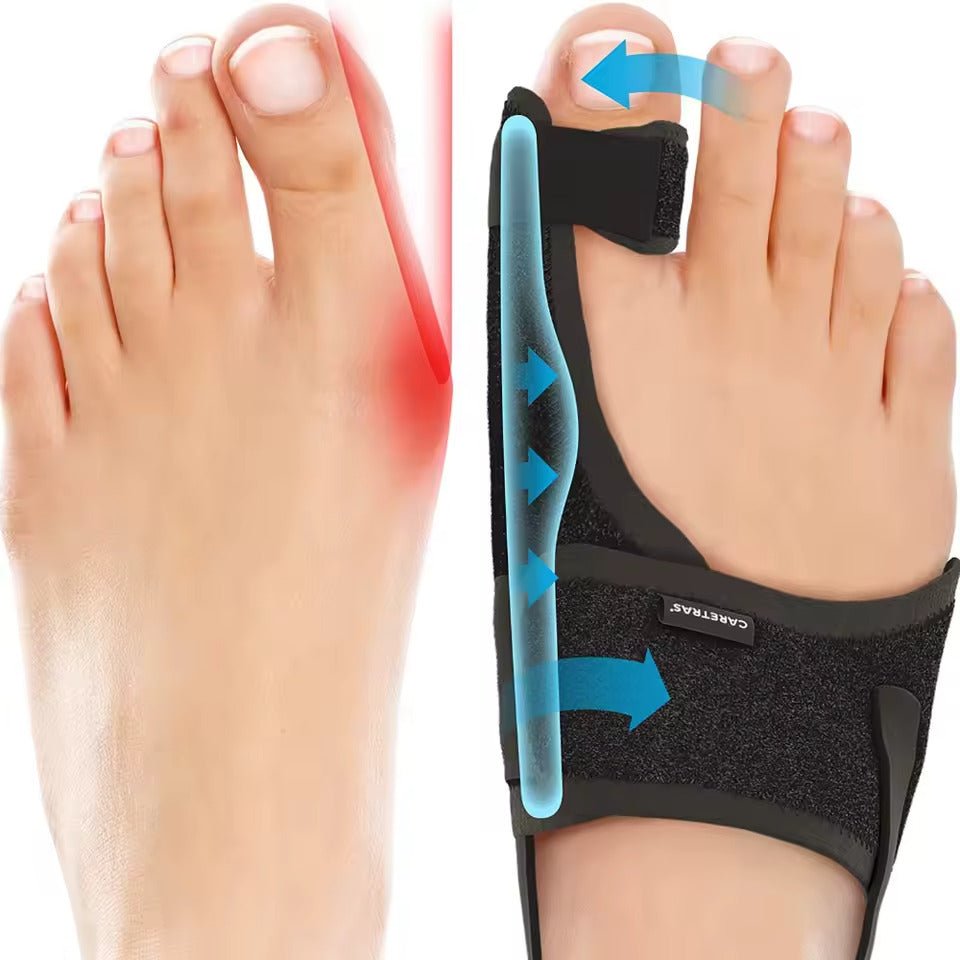Marcelie | Natskinne Hallux Valgus - Ergonomisk og Justerbar Komfort