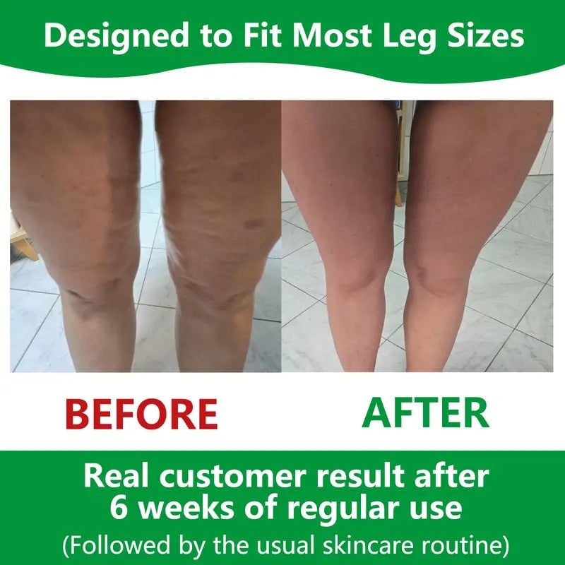 Marcelie | Sakerplus Cellulite Massage Roller