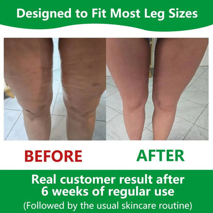 Marcelie | Sakerplus Cellulite Massage Roller