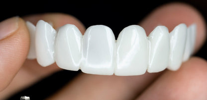 Marcelie | Snap-On Kosmetiske Facader | Øjeblikkelig Smile Dækning for Imperfektioner