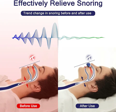 Micro CPAP Maskine til Rejse & Snorken - Medicinsk Silikone