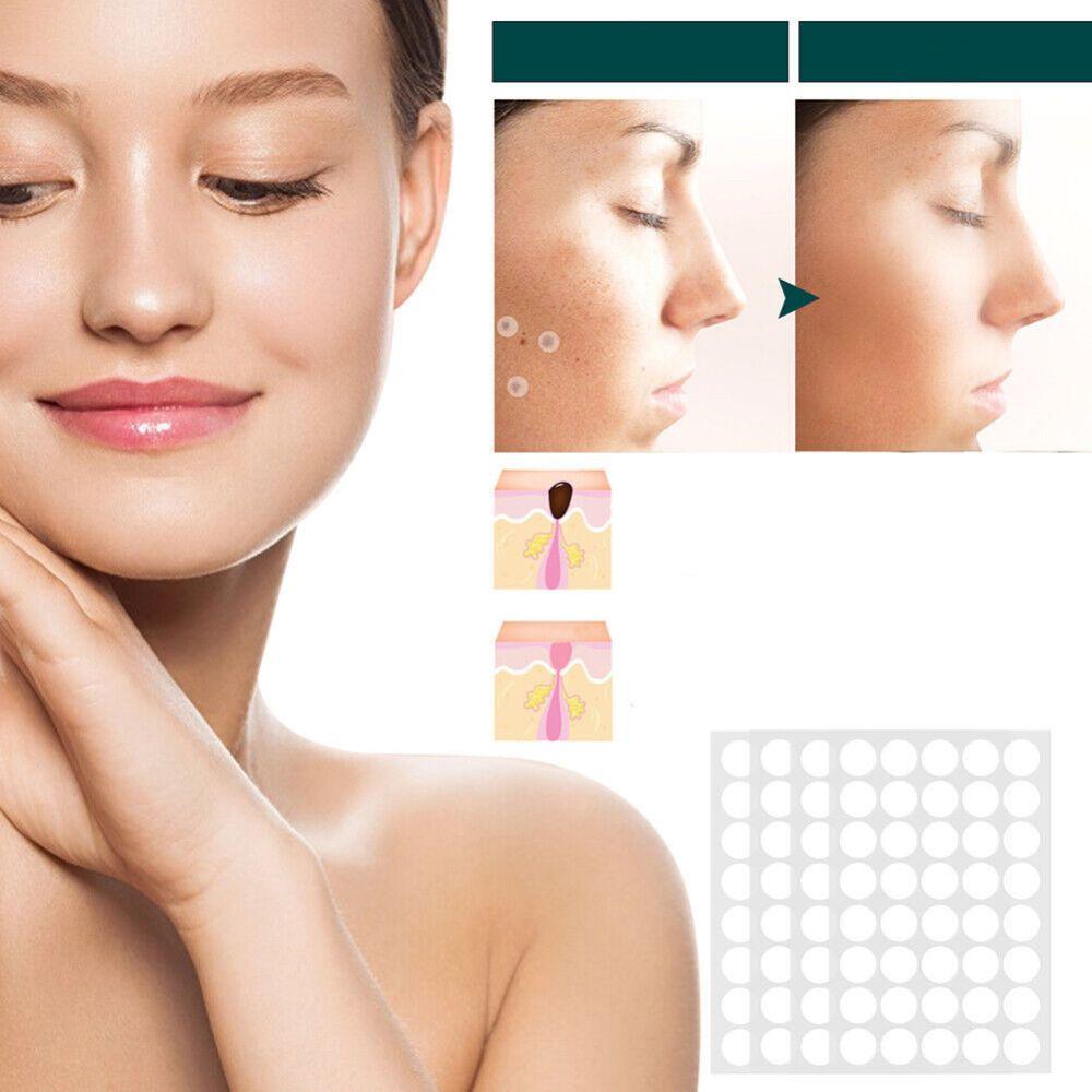 SkinClear - Patches til fjernelse af pletter og vorter Marcelie