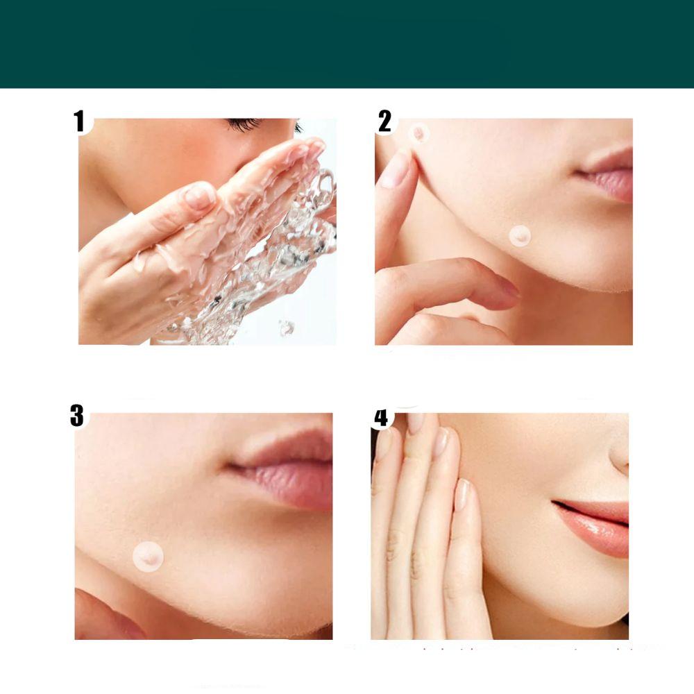 SkinClear - Patches til fjernelse af pletter og vorter Marcelie