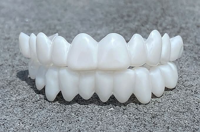 SmileFlex Tandprotes med Hvide Facader