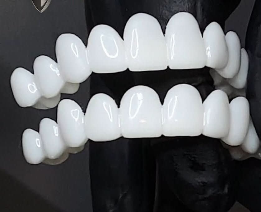 SmileFlex Tandprotes med Hvide Facader