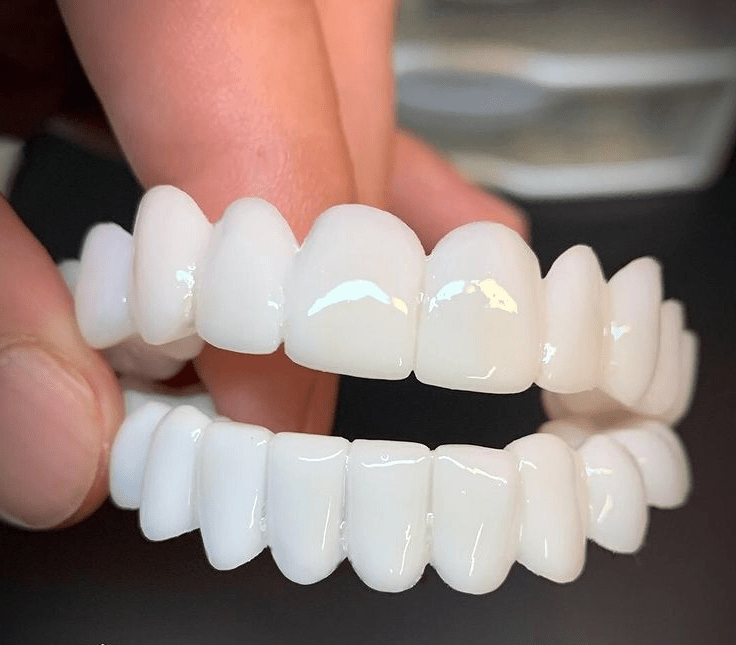 SmileFlex Tandprotes med Hvide Facader