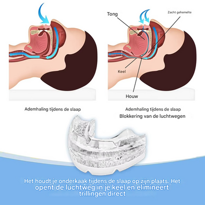SomnoPro™ | Den medicinske gennembrud, der definitivt stopper søvnapnø og snorken